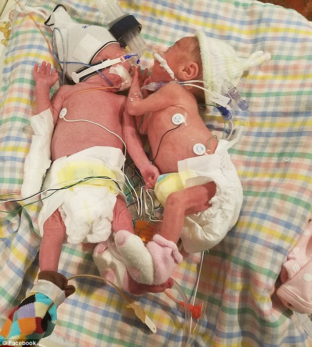 2 gemelli nati a 38 giorni di distanza Foto